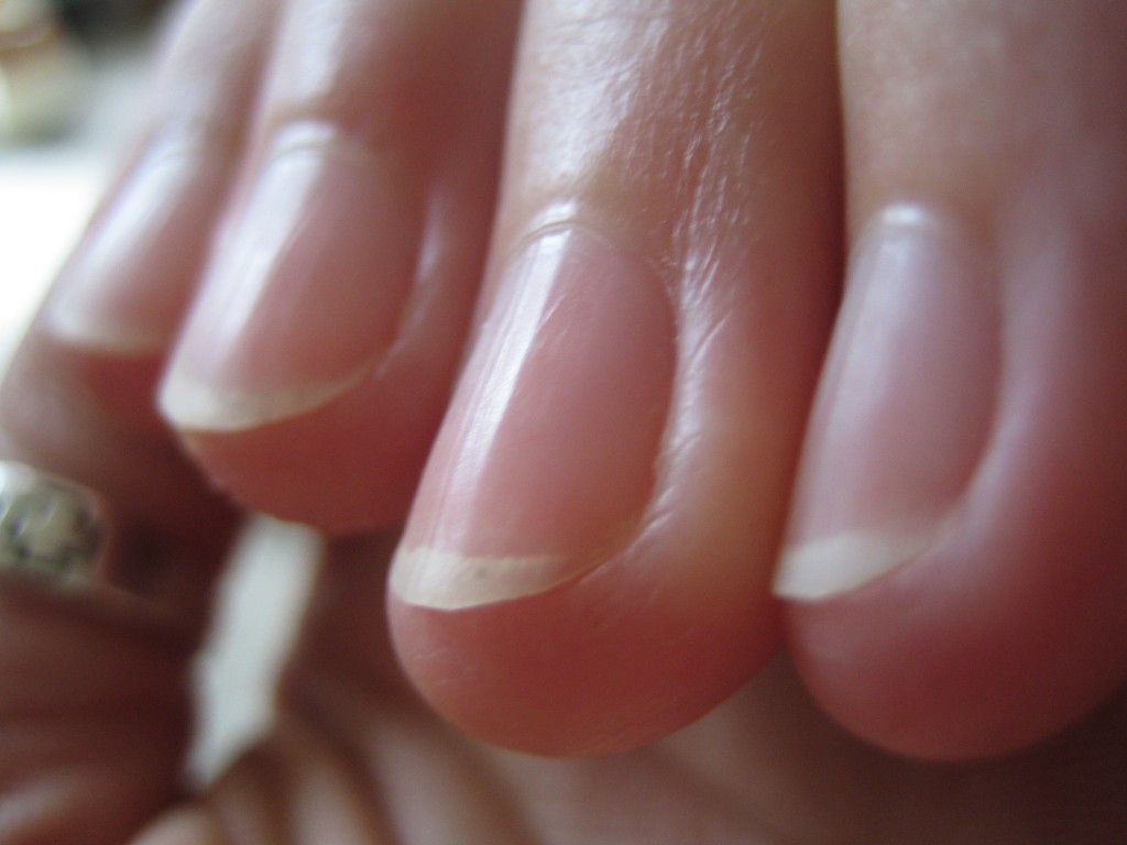 Understanding what your nails say about your health is a simple and often